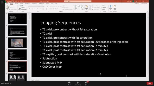 PART -1 BREAST MRI : THE BASICS AND MORE |RECORDED WEBINAR| смотреть онлайн