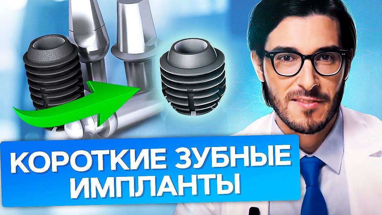 Короткие зубные импланты. Что такое короткие зубные импланты и в каких случаях устанавливаются?