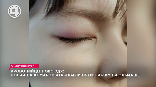 Полчища комаров атаковали пятиэтажку на Эльмаше