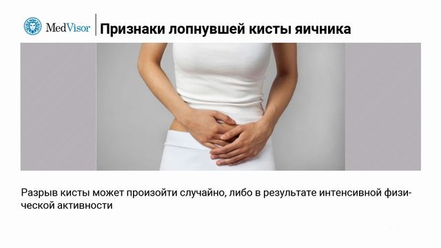 Признаки лопнувшей кисты яичника смотреть онлайн