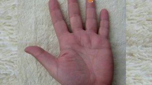 СуДжок. Простуда