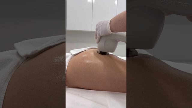 Программа подтяжки тела BODY UP - до -6 см в объеме | клиника косметологии GEN87 смотреть онлайн