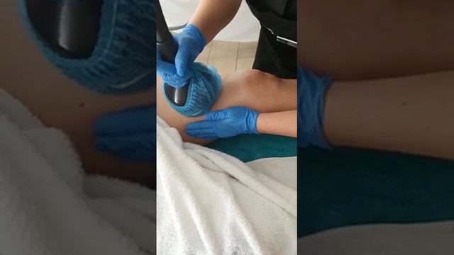 Soma Sense Spa leg treatment cellulite смотреть онлайн