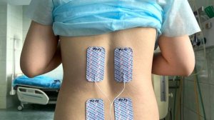 Новый электростимулятор снимает болевые ощущения у рожениц Нижневартовского перинатального центра