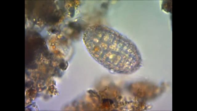 Инфузория под микроскопом under microscope смотреть онлайн