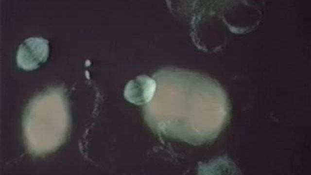 Positive Thinking for Alto Flute, Tape & Projection of Human Cells. By Anne Deane Berman смотреть онлайн