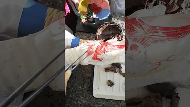 Строение дыхательной системы человека смотреть онлайн