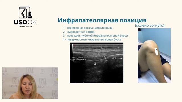 Видео урок УЗИ коленного сустава   алгоритм осмотра