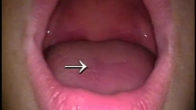 Анатомия шеи и височно-нижнечелюстного сустава: видеоатлас доктора Роберта Акланда смотреть онлайн