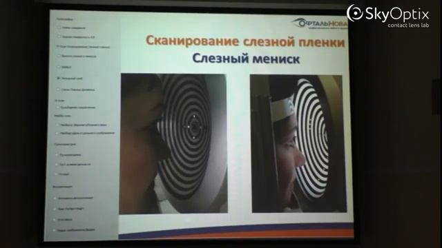 Максимальное использование возможностей «Keratograph 5М» смотреть онлайн