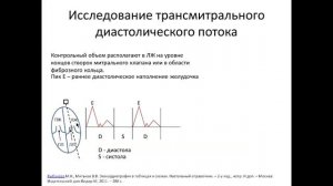 Основы ЭхоКГ:  допплерэхокардиография