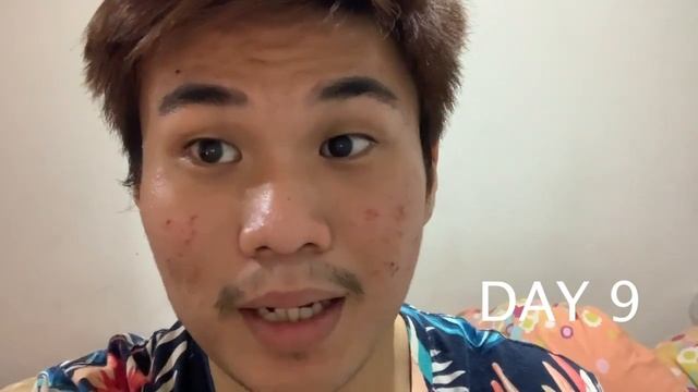 TOBAT DAH TCA CROSS 80%, TCA PEEL, DERMABRASI GOOD BYE ACNE SCARS ( bopeng jerawat ) смотреть онлайн