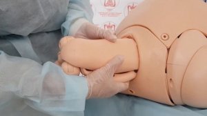 Алгоритм выполнения классического ручного пособия при тазовом предлежании плода