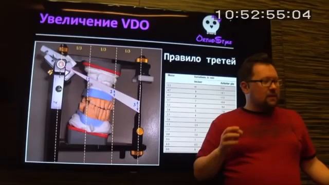 Методики определения высоты прикуса смотреть онлайн