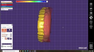 22. Шаблон для препарирования