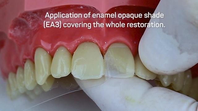 [ENG] Class IV restoration with Vittra APS смотреть онлайн