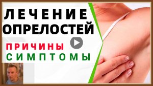ОПРЕЛОСТИ - ПРИЧИНЫ ЛЕЧЕНИЕ