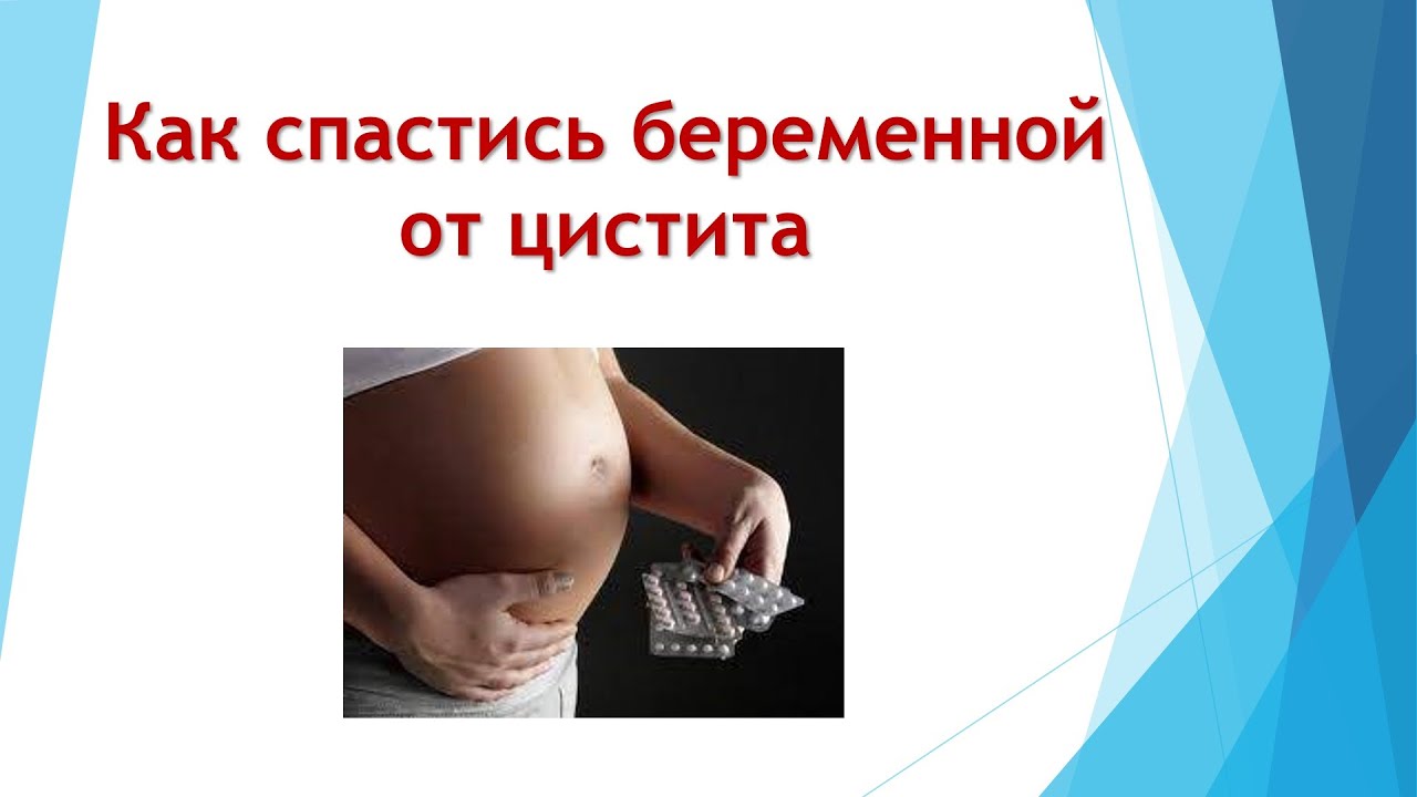 цистит у беременной смотреть онлайн