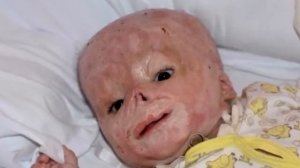 Мать сразу отказалась от ребёнка, когда увидела его в роддоме!