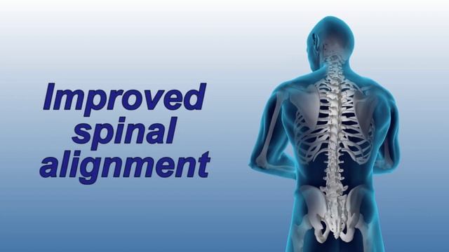 Scoliosis смотреть онлайн