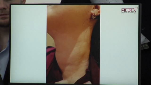 Нити для тредлифтинга, семинар доктора Юн Сонг Чжэ, 1 часть смотреть онлайн