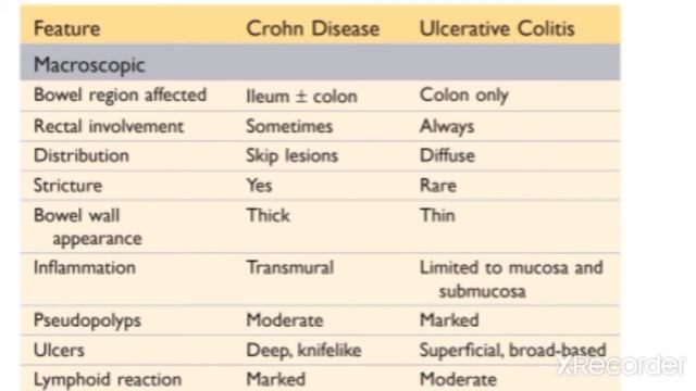 GIT Pathology 11 Major Topic: Ulcerative colitis,Clinical features of Inflammatory Bowel Disease смотреть онлайн