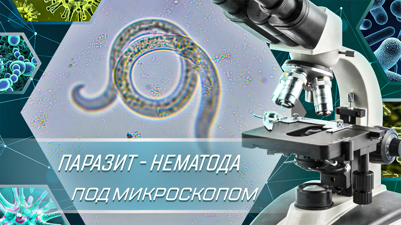 Нематоды под микроскопом смотреть онлайн
