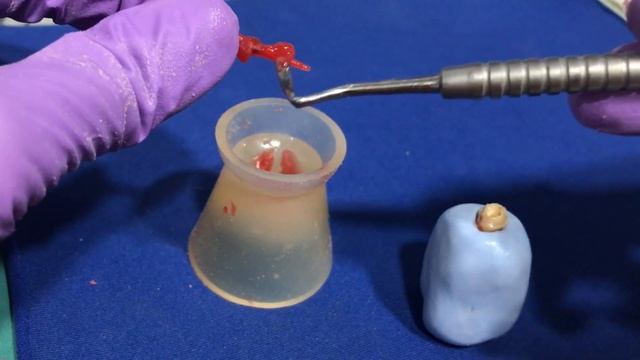 Customized Post and Core Demonstration - Direct and Indirect Technique смотреть онлайн