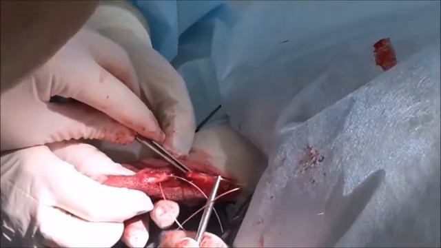 Оперативное лечение разрыва ахиллова сухожилия у собаки Ветлайн НИКОР смотреть онлайн