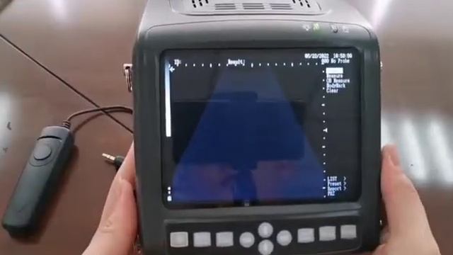 Узи-сканер КХ 5200 part 2 смотреть онлайн