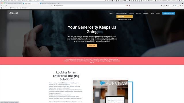 How to Open and View MRI or Xray images on Mac смотреть онлайн