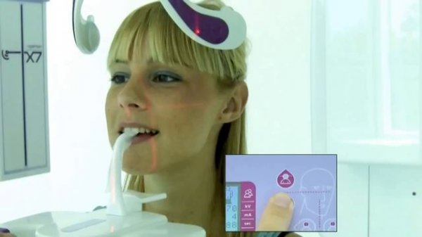 Позиционирование пациента ортопантомограф Hyperion X7