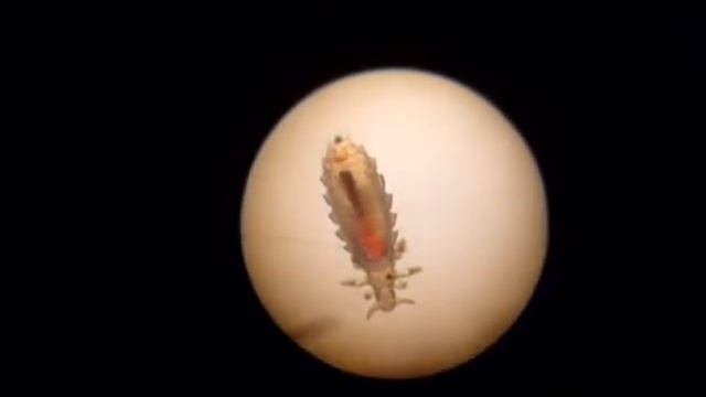 КРЫСИНАЯ ВОШЬ смотреть онлайн