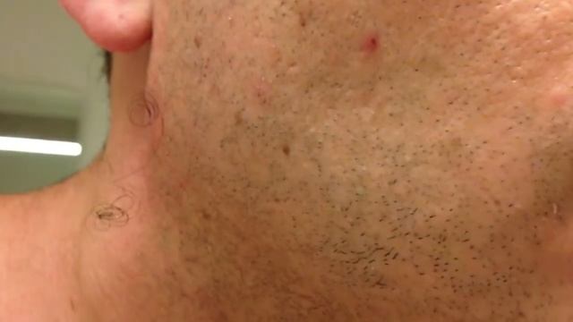 Как такое вообще могло попасть в щёку!!!! смотреть онлайн