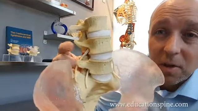 Hypermobile Lumbar Spine Model - Stress Shielding of Facets смотреть онлайн