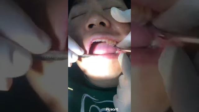 Trực tiếp quá trình nhổ răng không đau tại nhakhoanucuoiviet.net смотреть онлайн