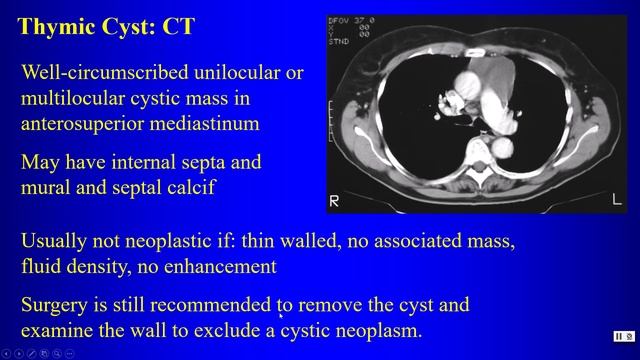 20a Anterior Mediastinum смотреть онлайн