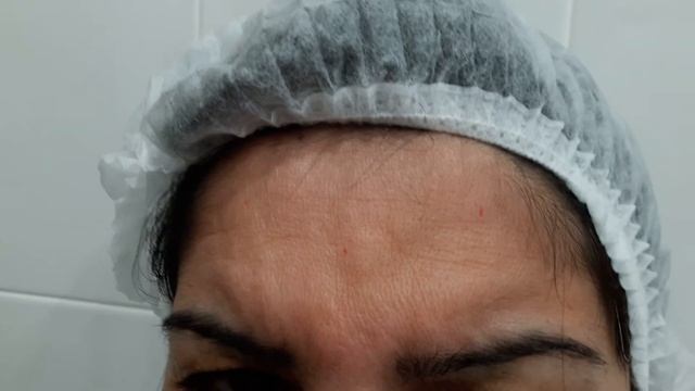 АирисКом Практические занятия студентов урок ботокс