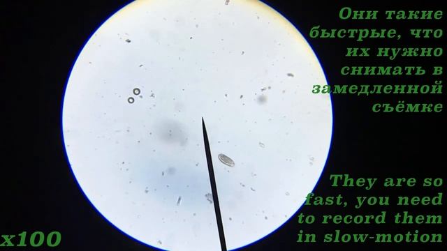 Инфузория туфелька - Paramecium смотреть онлайн