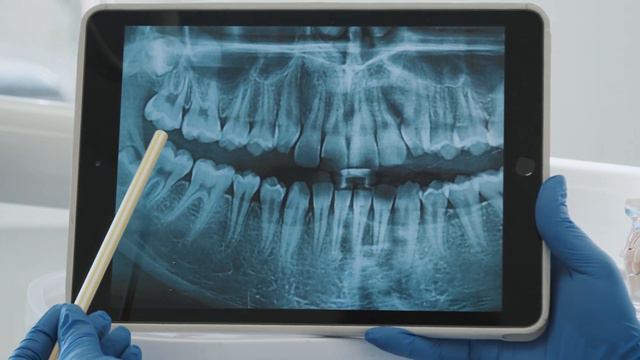 ЧТО БУДЕТ ЕСЛИ 7 ДНЕЙ ПИТЬ ВОДУ С ЛИМОНОМ #лимон #пищеварение #похудение #Здоровье #Питание" смотреть онлайн