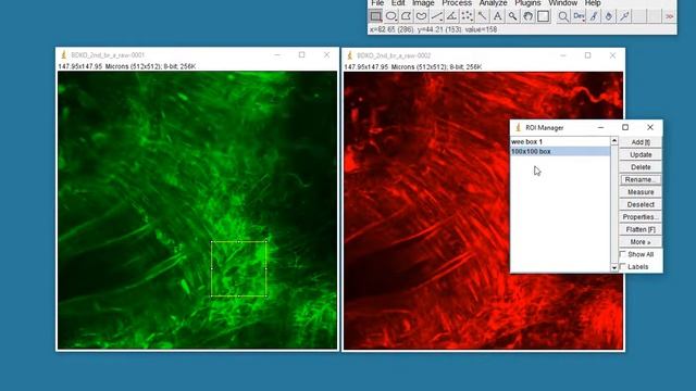 Measuring intensity in a digital image (ImageJ) смотреть онлайн