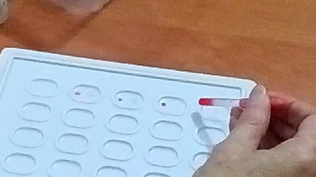 Определение системы групп крови АБО смотреть онлайн