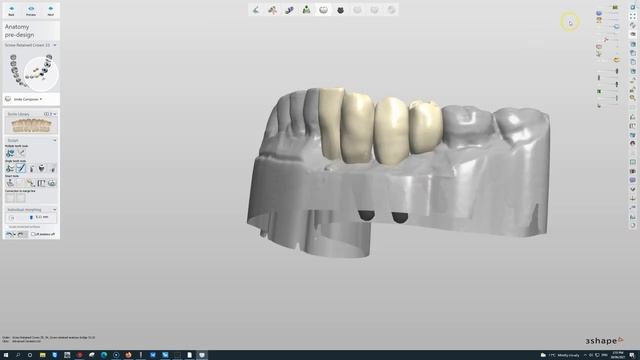 Recording #335 смотреть онлайн