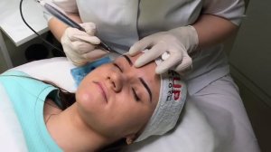 Удаление перманентного макияжа бровей ремувером Corona Colors