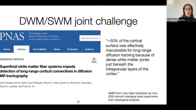 Deep learning for white matter parcellation смотреть онлайн
