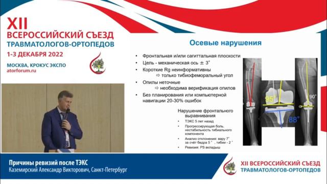 Причины ревизий после ТЭКС Каземирский Александр Викторович, Преображенский П.М., Накопия В.Б., смотреть онлайн
