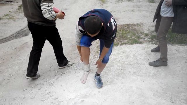 Охлаждение ушибленой ноги! смотреть онлайн