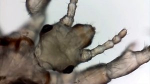 ОГРОМНЫЕ ВШИ ПЬЮТ КРОВЬ ПОД МИКРОСКОПОМ. КТО ТАКАЯ ВОШЬ?