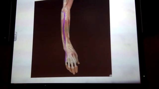 Complete Cadaver смотреть онлайн