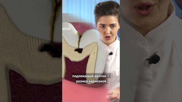 Средний #кариес - самый частый случай обращения к стоматологу смотреть онлайн